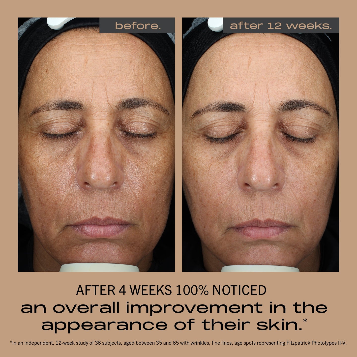 MATTER OF FACT MAXIMALIST AGE-DEFYING MOISTURIZER before and after image